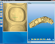 Sirona Cerec 3D and inLab *Dongle Emulator (Dongle Crack) for Sentinel Hardware Key*