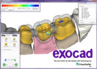 exocad DentalCAD 2011.03.18 *Unlimited Computers Dongle Emulator (Dongle Crack) for MICROCOSM Dinkey Dongle* exocad DentalCAD 2011.03.18 *Unlimited Computers Dongle Emulator (Dongle Crack) for MICROCOSM Dinkey Dongle*